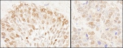 NUP50 Antibody, Novus Biologicals 0.1mL; Unlabeled:Antibodies, Polyclonal